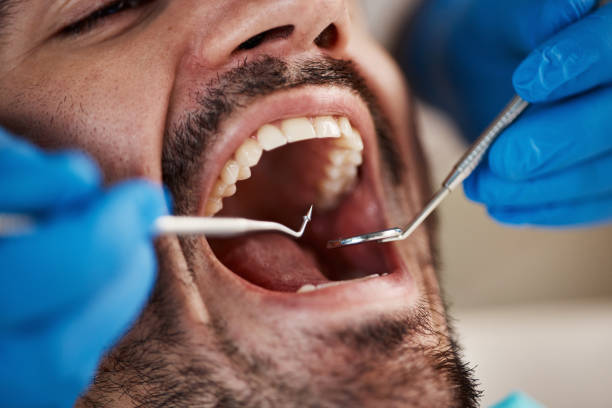 Best Same-Day Emergency Dentist in Oakland, OR