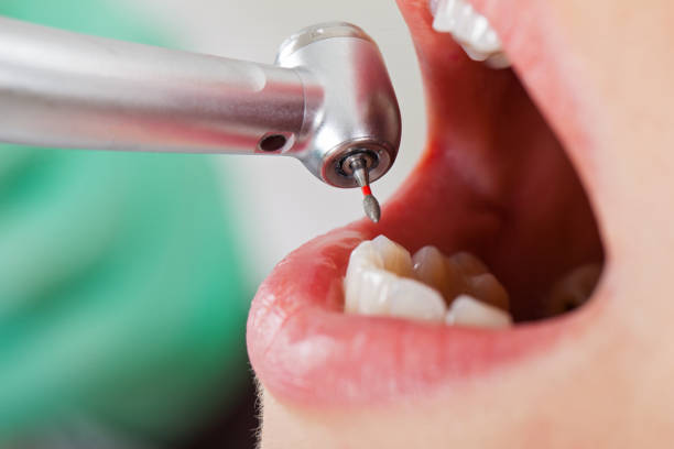 Best Emergency Treatment for Toothache in Oakland, OR